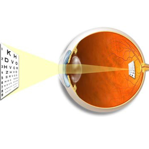 Eye hospital in Panchkula,